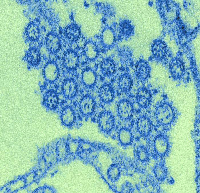 CDC于2009年拍摄并数字着色的甲型H1N1流感病毒透射电子显微照片